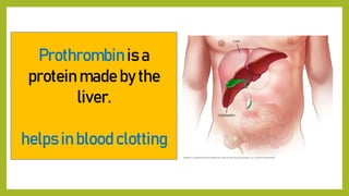 Prothrombin is a
protein made by the
liver.
helps in blood clotting
 