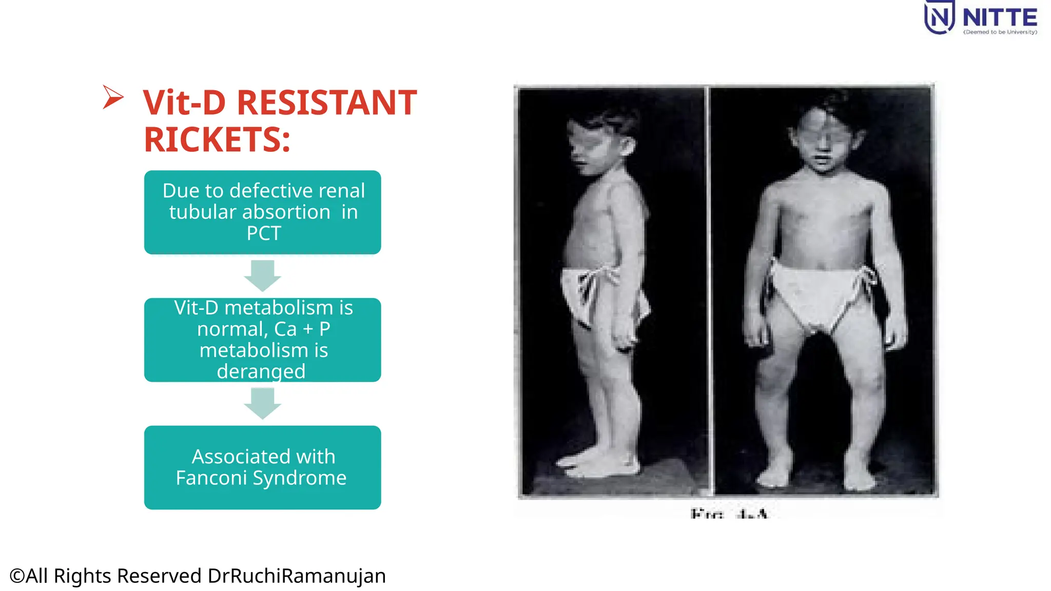 VITAMIN-D: THE SUNSHINE HORMONE: EVERYTHING YOU NEED TO KNOW | PPTX