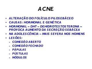 ACNE ALTERAÇÃO DO FOLÍCULO PILOSEBÁCEO CAUSAS: HORMONAL E GENÉTICA HORMONAL – DHT – DEHIDROTESTOSTERONA – PROVOCA AUMENTO DA SECREÇÃO SEBÁCEA NA ADOLESCÊNCIA – MAIS SEVERA NOS HOMENS LESÕES: COMEDÃO ABERTO COMEDÃO FECHADO PÁPULAS PÚSTULAS NÓDULOS 
