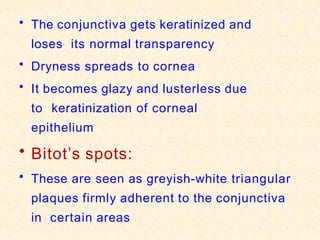 • The conjunctiva gets keratinized and
loses its normal transparency
• Dryness spreads to cornea
• It becomes glazy and lusterless due
to keratinization of corneal
epithelium
• Bitot’s spots:
• These are seen as greyish-white triangular
plaques firmly adherent to the conjunctiva
in certain areas
 