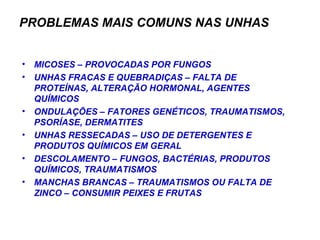 PROBLEMAS MAIS COMUNS NAS UNHAS MICOSES – PROVOCADAS POR FUNGOS UNHAS FRACAS E QUEBRADIÇAS – FALTA DE PROTEÍNAS, ALTERAÇÃO HORMONAL, AGENTES QUÍMICOS ONDULAÇÕES – FATORES GENÉTICOS, TRAUMATISMOS, PSORÍASE, DERMATITES UNHAS RESSECADAS – USO DE DETERGENTES E PRODUTOS QUÍMICOS EM GERAL DESCOLAMENTO – FUNGOS, BACTÉRIAS, PRODUTOS QUÍMICOS, TRAUMATISMOS MANCHAS BRANCAS – TRAUMATISMOS OU FALTA DE ZINCO – CONSUMIR PEIXES E FRUTAS 
