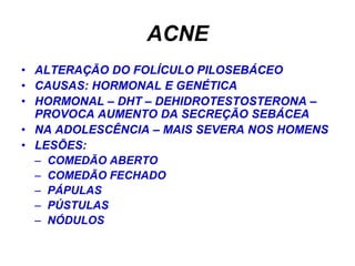 ACNE
• ALTERAÇÃO DO FOLÍCULO PILOSEBÁCEO
• CAUSAS: HORMONAL E GENÉTICA
• HORMONAL – DHT – DEHIDROTESTOSTERONA –
  PROVOCA AUMENTO DA SECREÇÃO SEBÁCEA
• NA ADOLESCÊNCIA – MAIS SEVERA NOS HOMENS
• LESÕES:
  – COMEDÃO ABERTO
  – COMEDÃO FECHADO
  – PÁPULAS
  – PÚSTULAS
  – NÓDULOS
 