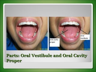 Parts: Oral Vestibule and Oral Cavity Proper 