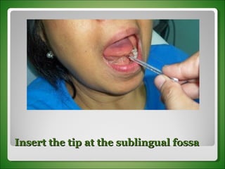 Insert the tip at the sublingual fossa 