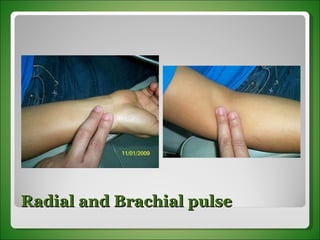 Radial and Brachial pulse 
