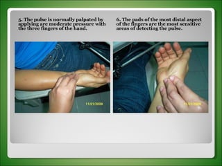 5. The pulse is normally palpated by applying are moderate pressure with the three fingers of the hand. 6. The pads of the most distal aspect of the fingers are the most sensitive areas of detecting the pulse. 