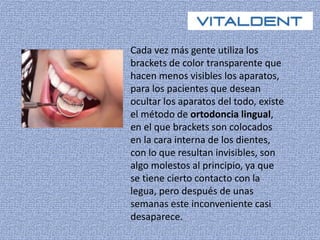 Cada vez más gente utiliza los 
brackets de color transparente que 
hacen menos visibles los aparatos, 
para los pacientes que desean 
ocultar los aparatos del todo, existe 
el método de ortodoncia lingual, 
en el que brackets son colocados 
en la cara interna de los dientes, 
con lo que resultan invisibles, son 
algo molestos al principio, ya que 
se tiene cierto contacto con la 
legua, pero después de unas 
semanas este inconveniente casi 
desaparece. 
 