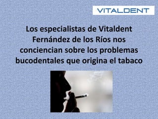 Los especialistas de Vitaldent 
Fernández de los Ríos nos 
conciencian sobre los problemas 
bucodentales que origina el tabaco 
 