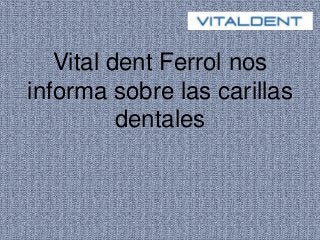 Vital dent Ferrol nos
informa sobre las carillas
dentales
 