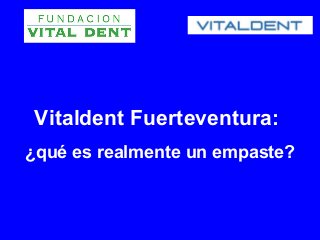Vitaldent Fuerteventura:
¿qué es realmente un empaste?
 