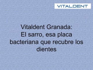 Vitaldent Granada:
El sarro, esa placa
bacteriana que recubre los
dientes
 