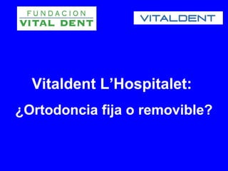 Vitaldent L’Hospitalet:
¿Ortodoncia fija o removible?
 