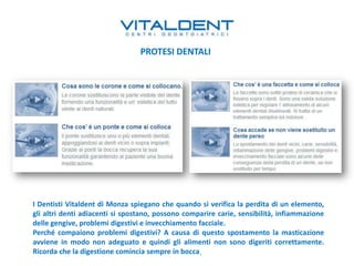 I Dentisti Vitaldent di Monza spiegano che quando si verifica la perdita di un elemento,
gli altri denti adiacenti si spostano, possono comparire carie, sensibilità, infiammazione
delle gengive, problemi digestivi e invecchiamento facciale.
Perché compaiono problemi digestivi? A causa di questo spostamento la masticazione
avviene in modo non adeguato e quindi gli alimenti non sono digeriti correttamente.
Ricorda che la digestione comincia sempre in bocca.
PROTESI DENTALI
 