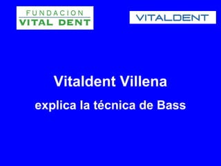 Vitaldent Villena
explica la técnica de Bass
 