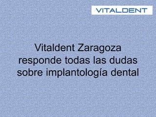 Vitaldent Zaragoza
responde todas las dudas
sobre implantología dental
 