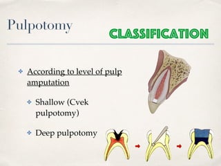 Pulpotomy
✤ According to level of pulp
amputation
✤ Shallow (Cvek
pulpotomy)
✤ Deep pulpotomy
Classification
 