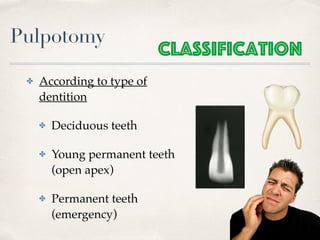 Pulpotomy
✤ According to type of
dentition
✤ Deciduous teeth
✤ Young permanent teeth
(open apex)
✤ Permanent teeth
(emergency)
Classification
 