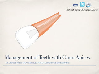 Management ofTeeth with Open Apices
Dr. Ashraf Refai (BDS MSc DD HMD) Lecturer of Endodontics
ashraf_refai@hotmail.com
 