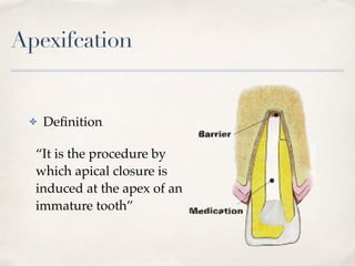 Apexifcation
✤ Deﬁnition
“It is the procedure by
which apical closure is
induced at the apex of an
immature tooth”
 