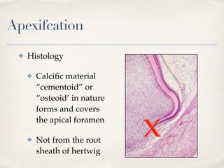 Apexifcation
✤ Histology
✤ Calciﬁc material
“cementoid” or
“osteoid’ in nature
forms and covers
the apical foramen
✤ Not from the root
sheath of hertwig
x
 