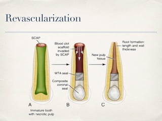 Revascularization
 