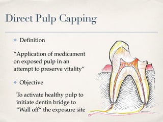 Direct Pulp Capping
✤ Deﬁnition
“Application of medicament
on exposed pulp in an
attempt to preserve vitality”
✤ Objective
To activate healthy pulp to
initiate dentin bridge to
“Wall off” the exposure site
 