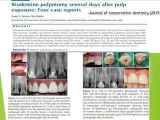 -Journal of conservative dentistry,(2015)
 