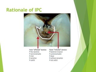 Rationale of IPC
 