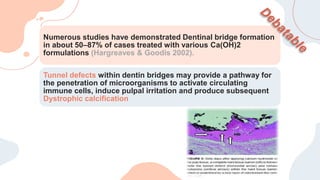 Numerous studies have demonstrated Dentinal bridge formation
in about 50–87% of cases treated with various Ca(OH)2
formulations (Hargreaves & Goodis 2002).
Tunnel defects within dentin bridges may provide a pathway for
the penetration of microorganisms to activate circulating
immune cells, induce pulpal irritation and produce subsequent
Dystrophic calcification
 