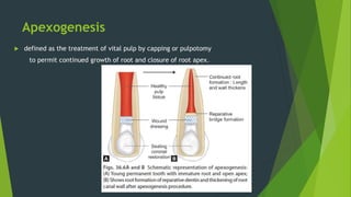 Apexogenesis
 defined as the treatment of vital pulp by capping or pulpotomy
to permit continued growth of root and closure of root apex.
 