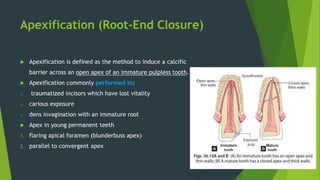 Apexification (Root-End Closure)
 Apexification is defined as the method to induce a calcific
barrier across an open apex of an immature pulpless tooth.
 Apexification commonly performed in:
o traumatized incisors which have lost vitality
o carious exposure
o dens invagination with an immature root
 Apex in young permanent teeth
1. flaring apical foramen (blunderbuss apex)
2. parallel to convergent apex
 