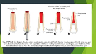 Vital Pulp Therapy.pptxVital Pulp Therapy.pptx