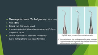  Two-appointment Technique (Figs. 36.1A to C)
1. First sitting
2. Second visit (6–8 weeks later)
 If remaining dentin thickness is approximately 0.5–2 mm,
prognosis is better
 calcium hydroxide has been used successfully
due to its high pH and hard tissue formation
 