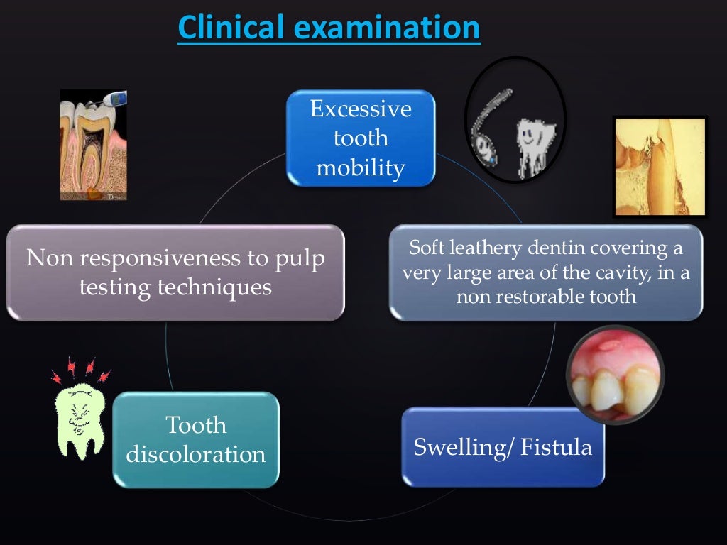 Vital pulp therapy in primary and permanent tooth