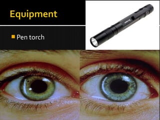  Pen torch
 
