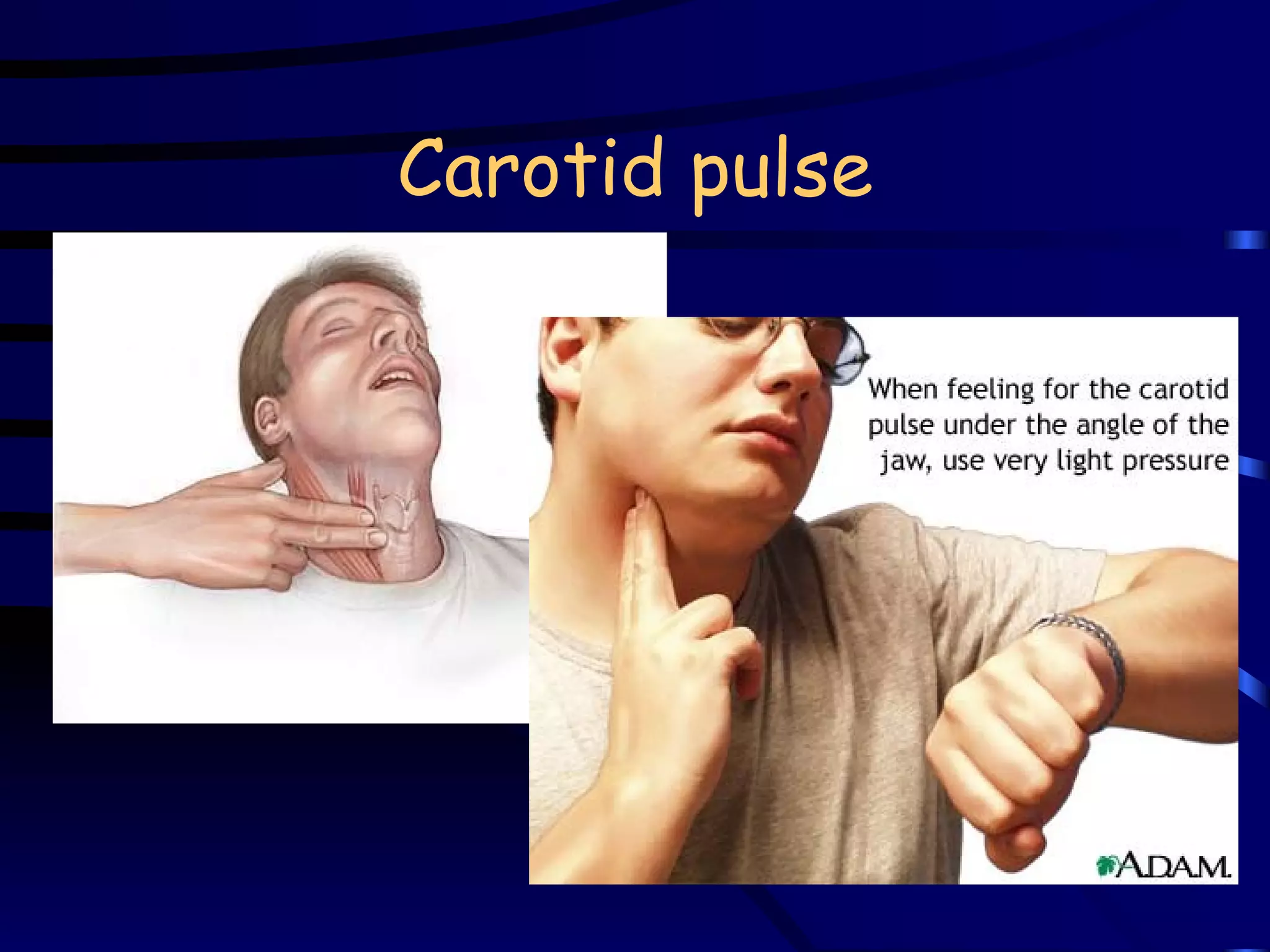 Carotid pulse 
