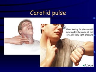 Carotid pulse 