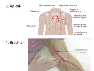 3. Apical-
4. Brachial-
 