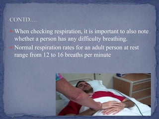  When checking respiration, it is important to also note
whether a person has any difficulty breathing.
 Normal respiration rates for an adult person at rest
range from 12 to 16 breaths per minute
 