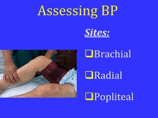 Assessing BP
Sites:
Brachial
Radial
Popliteal
 