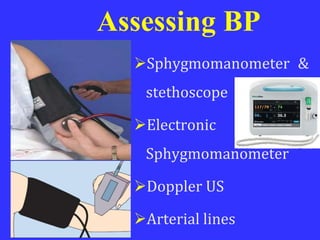 Assessing BP
Sphygmomanometer &
stethoscope
Electronic
Sphygmomanometer
Doppler US
Arterial lines
 
