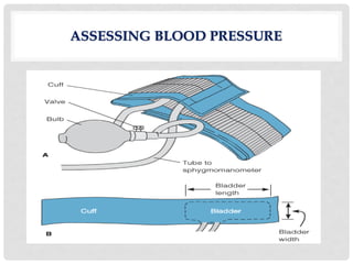 ASSESSING BLOOD PRESSURE
 
