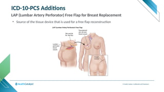 © Health Catalyst. Confidential and Proprietary.
ICD-10-PCS Additions
LAP (Lumbar Artery Perforator) Free Flap for Breast Replacement
• Source of the tissue device that is used for a free flap reconstruction
https://libmaneducation.com/
 