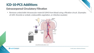 © Health Catalyst. Confidential and Proprietary.
ICD-10-PCS Additions
Extracorporeal Circulatory Filtration
• Removes undesirable intravascular material (UIM) from blood using a filtration circuit. (Examples
of UIM: thrombi or emboli, endocarditis vegetation, or infective exudate)
www.libmaneducation.com
 