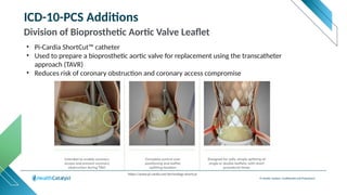 © Health Catalyst. Confidential and Proprietary.
ICD-10-PCS Additions
Division of Bioprosthetic Aortic Valve Leaflet
• Pi-Cardia ShortCut™ catheter
• Used to prepare a bioprosthetic aortic valve for replacement using the transcatheter
approach (TAVR)
• Reduces risk of coronary obstruction and coronary access compromise
https://www.pi-cardia.net/technology-shortcut
 