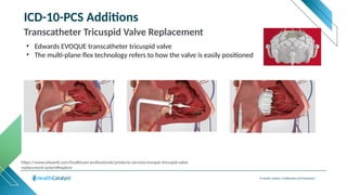 © Health Catalyst. Confidential and Proprietary.
ICD-10-PCS Additions
Transcatheter Tricuspid Valve Replacement
• Edwards EVOQUE transcatheter tricuspid valve
• The multi-plane flex technology refers to how the valve is easily positioned
https://www.edwards.com/healthcare-professionals/products-services/evoque-tricuspid-valve-
replacement-system#explore
 