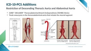 © Health Catalyst. Confidential and Proprietary.
ICD-10-PCS Additions
Restriction of Descending Thoracic Aorta and Abdominal Aorta
• GORE® EXCLUDER® Thoracoabdominal Branch Endoprosthesis (TAMBE) Device
• Treats aneurysms in the thoracoabdominal aorta that include the visceral segment
www.libmaneducation.com
 