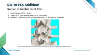 © Health Catalyst. Confidential and Proprietary.
ICD-10-PCS Additions
Fixation of Lumbar Facet Joint
• Facet FiXation (FFX®) device
• Treats facet joint degeneration (facet syndrome)
• Posterior cages to fuse the posterior elements of the spine at one level
https://thespinemarketgroup.com/sc-medica-announces-landmark-fda-clearance-for-its-ffx-facet-cage-for-lumbar-spinal-fusion/
 