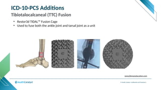 © Health Catalyst. Confidential and Proprietary.
ICD-10-PCS Additions
Tibiotalocalcaneal (TTC) Fusion
• Restor3d TIDAL™ Fusion Cage
• Used to fuse both the ankle joint and tarsal joint as a unit
www.libmaneducation.com
 