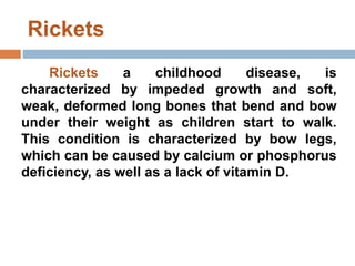 Rickets
Rickets a childhood disease, is
characterized by impeded growth and soft,
weak, deformed long bones that bend and bow
under their weight as children start to walk.
This condition is characterized by bow legs,
which can be caused by calcium or phosphorus
deficiency, as well as a lack of vitamin D.
 